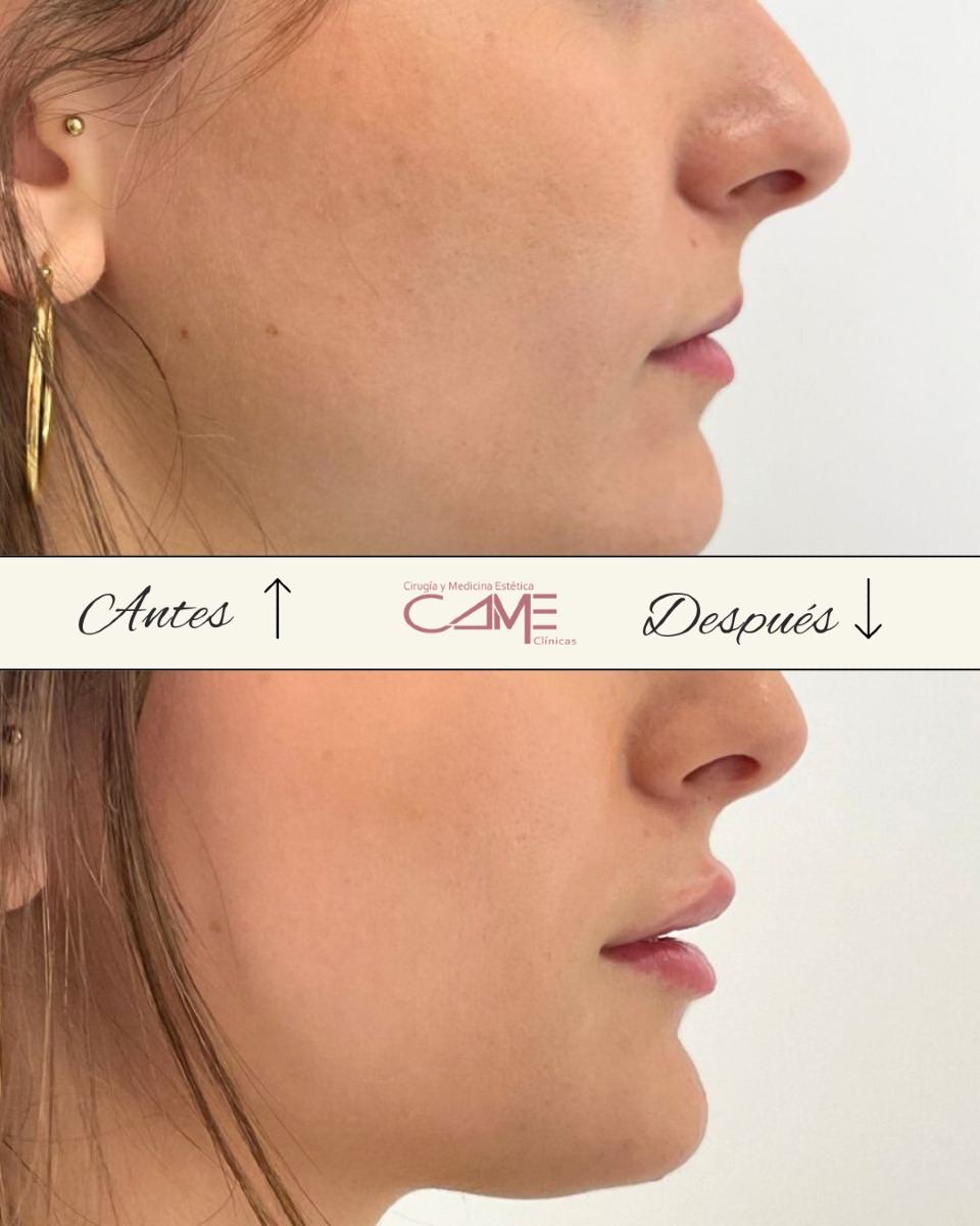 522139267_18053118842622440_5399124910044336355_n