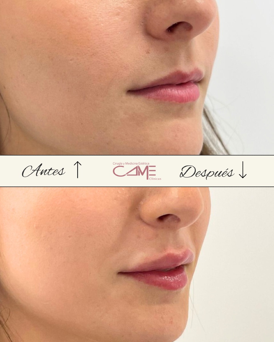 522645025_18053118830622440_1474149209639787750_n