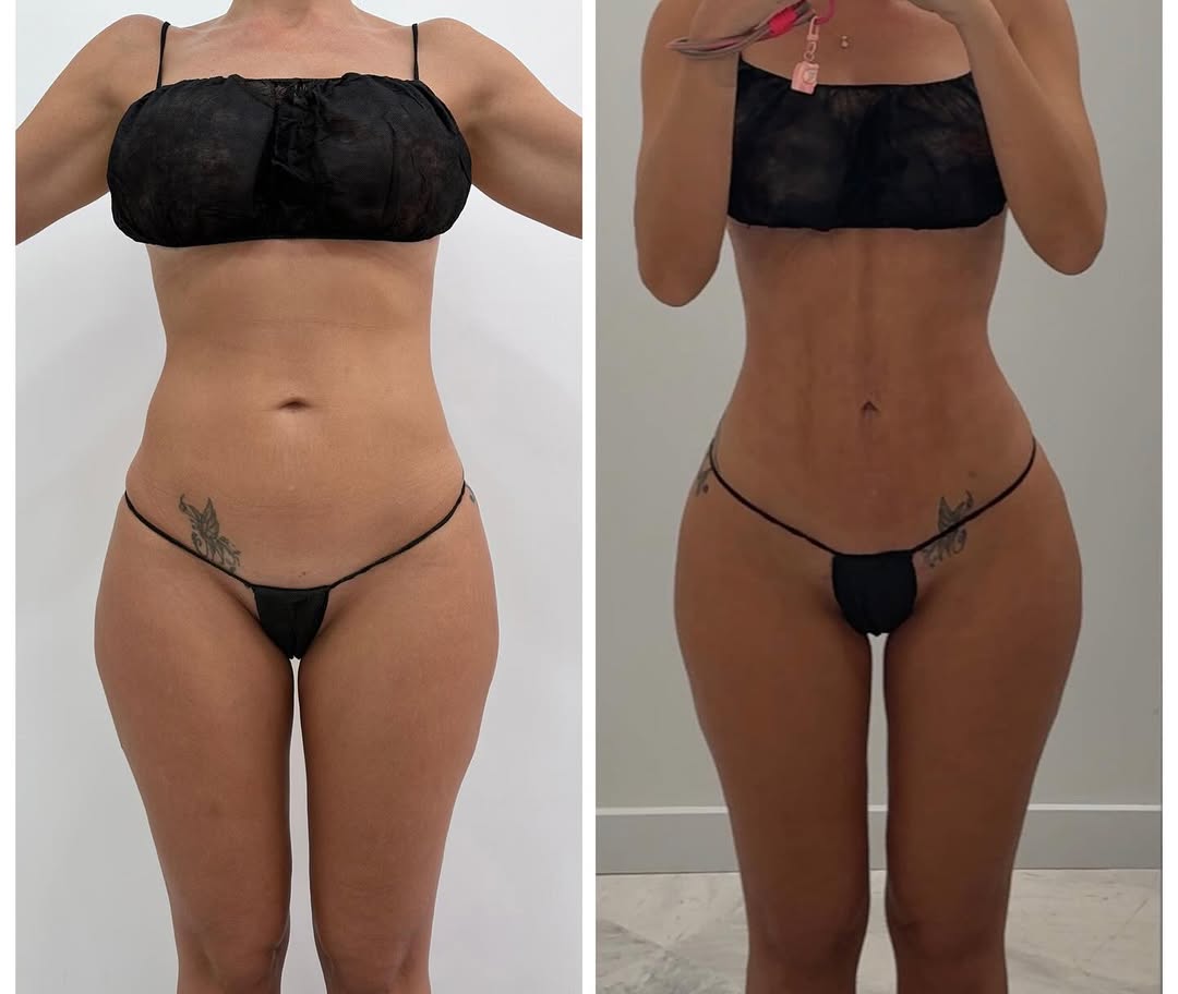 571904996_18065242823622440_6682976282723089404_n