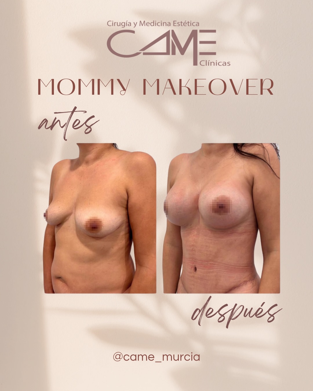 613761531_18073194410622440_7511227871581562613_n