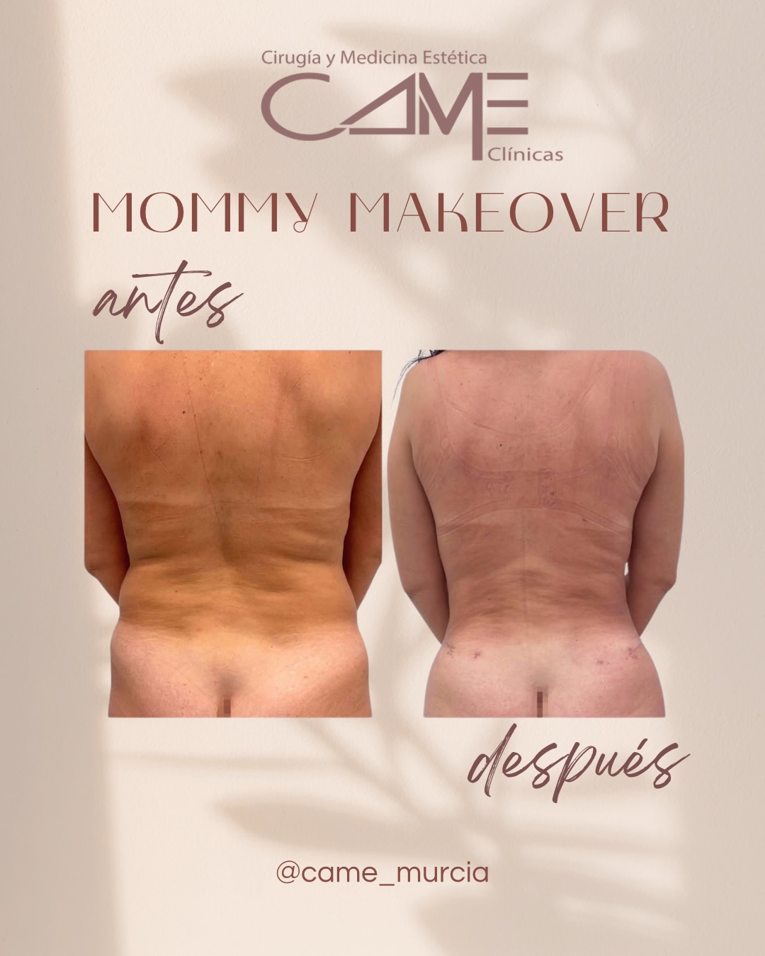 615144904_18073194419622440_1301454515795325848_n