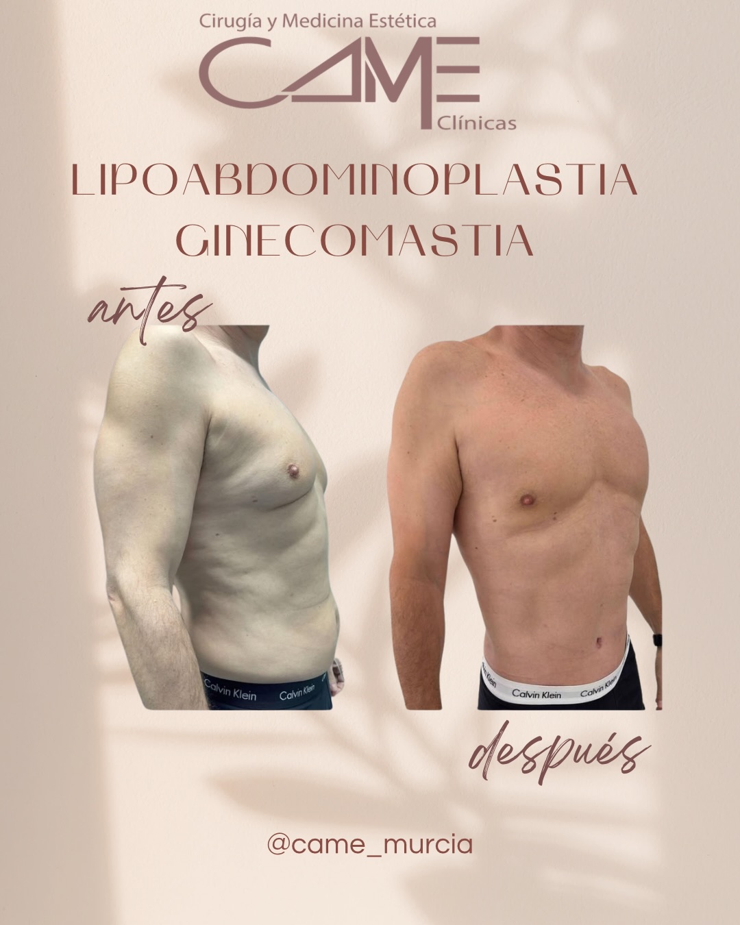 615227516_18073301483622440_2968480843605911060_n