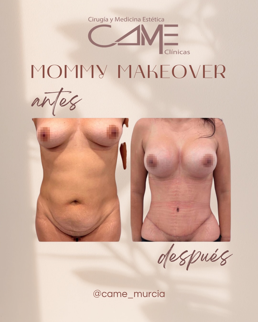 615277754_18073194392622440_7285670349163997560_n