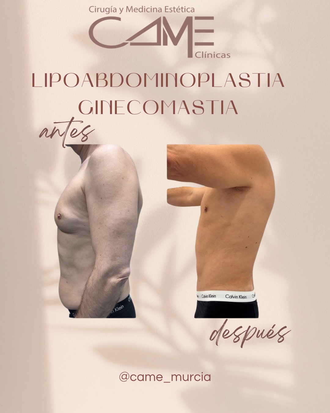 615463792_18073301492622440_2475285076395595885_n