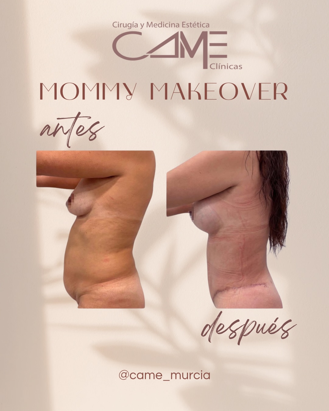 615693339_18073194437622440_179272886342820384_n