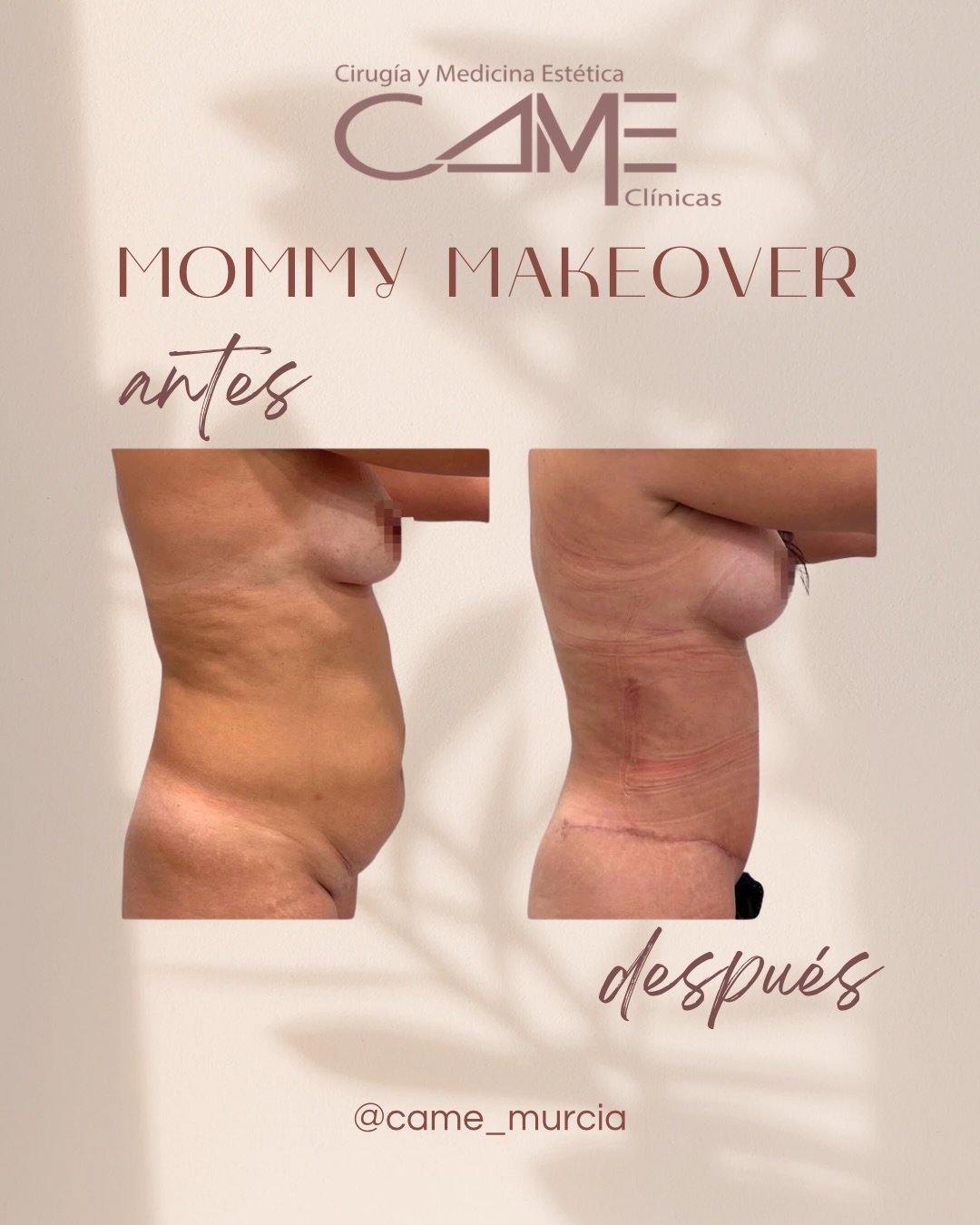 615715967_18073194428622440_3472265016386629973_n