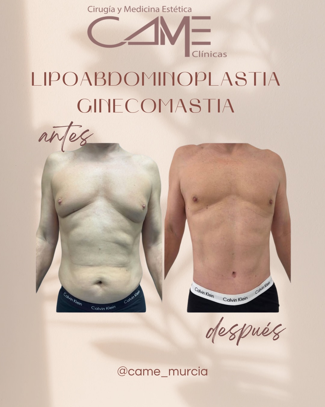 615762423_18073301465622440_7510929143086476174_n