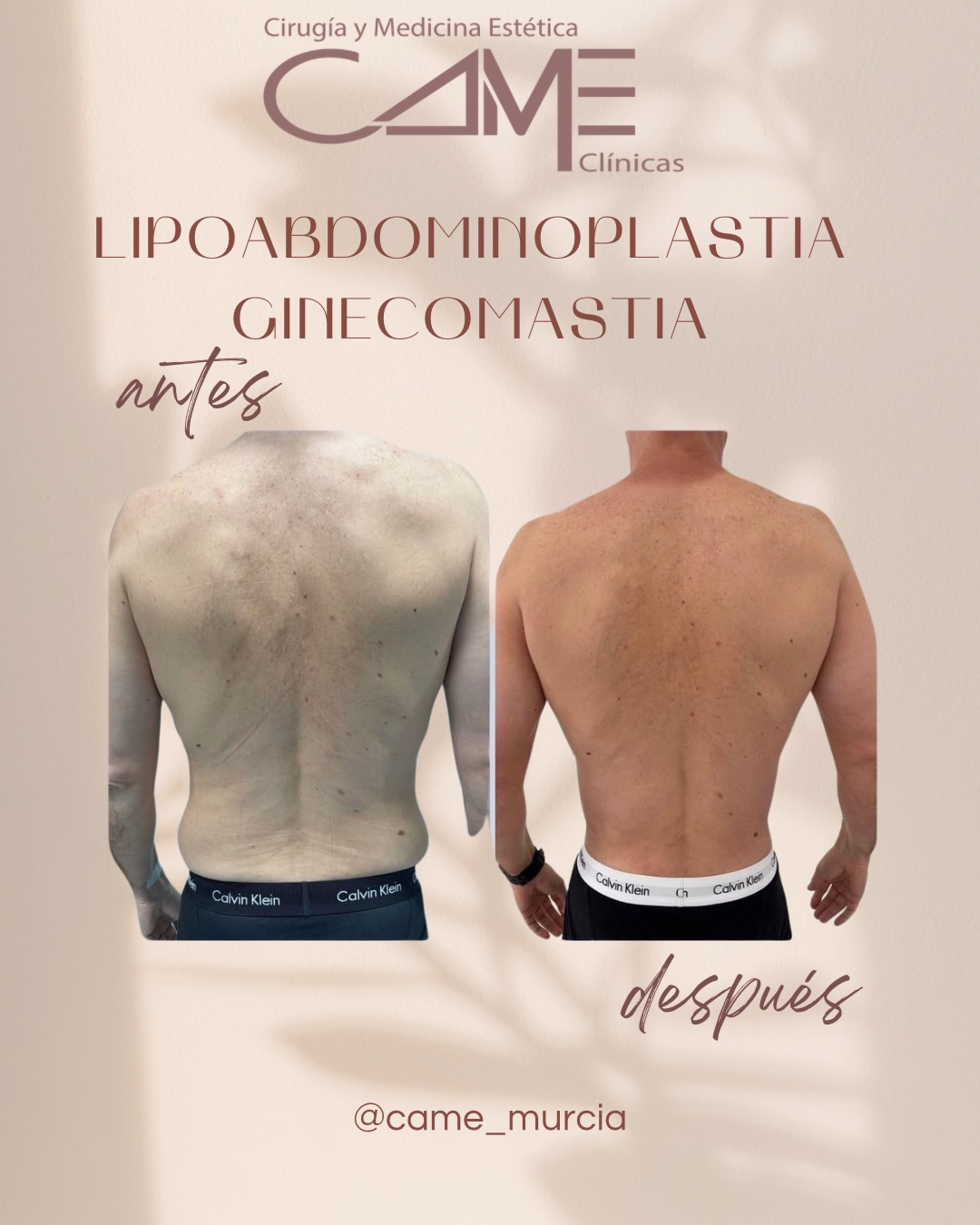 616550745_18073301474622440_3040823283532841990_n