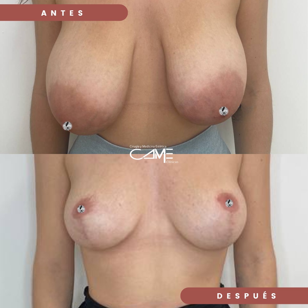 No hay mayor satisfacción que la de ver un trabajo bien hecho, gracias a nuestro increíble @drpe - copia