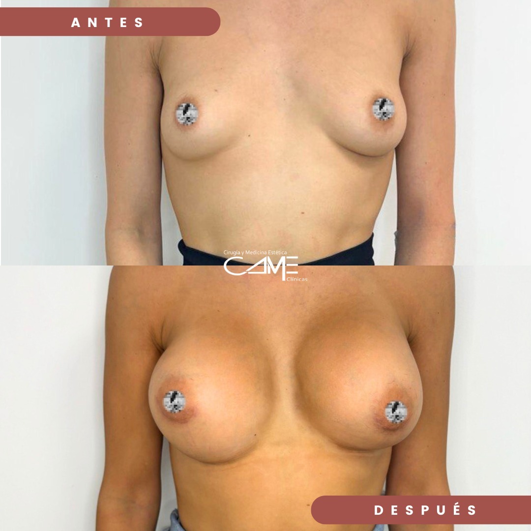 Nuestra paciente quería un cambio, quería sentirse bien consigo misma y necesitaba una dosis de (1) - copia