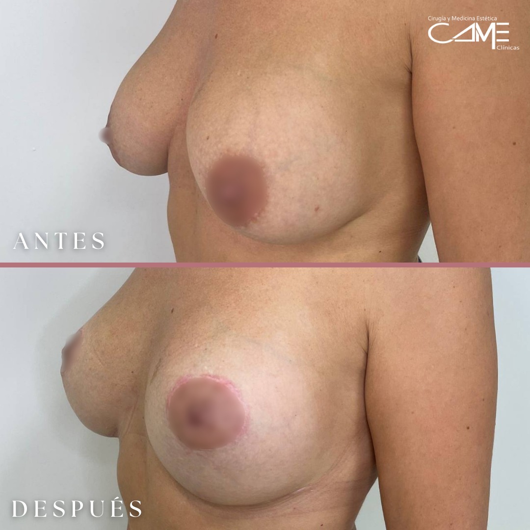 ¡Resultados increíbles y naturales! ✨Hoy te contamos la historia de nuestra paciente, la cual qu (1) - copia