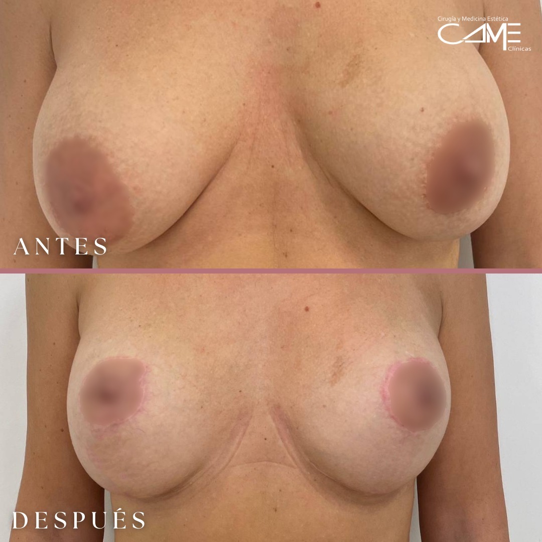 ¡Resultados increíbles y naturales! ✨Hoy te contamos la historia de nuestra paciente, la cual qu - copia