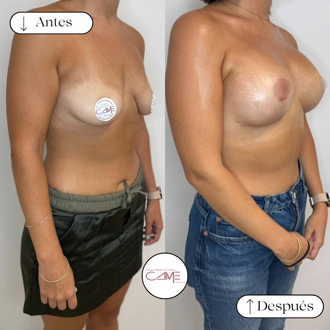 💖✨ En CLÍNICA CAME, hacemos realidad los sueños de nuestras pacientes ✨🌟Si estás pensando en d (1)