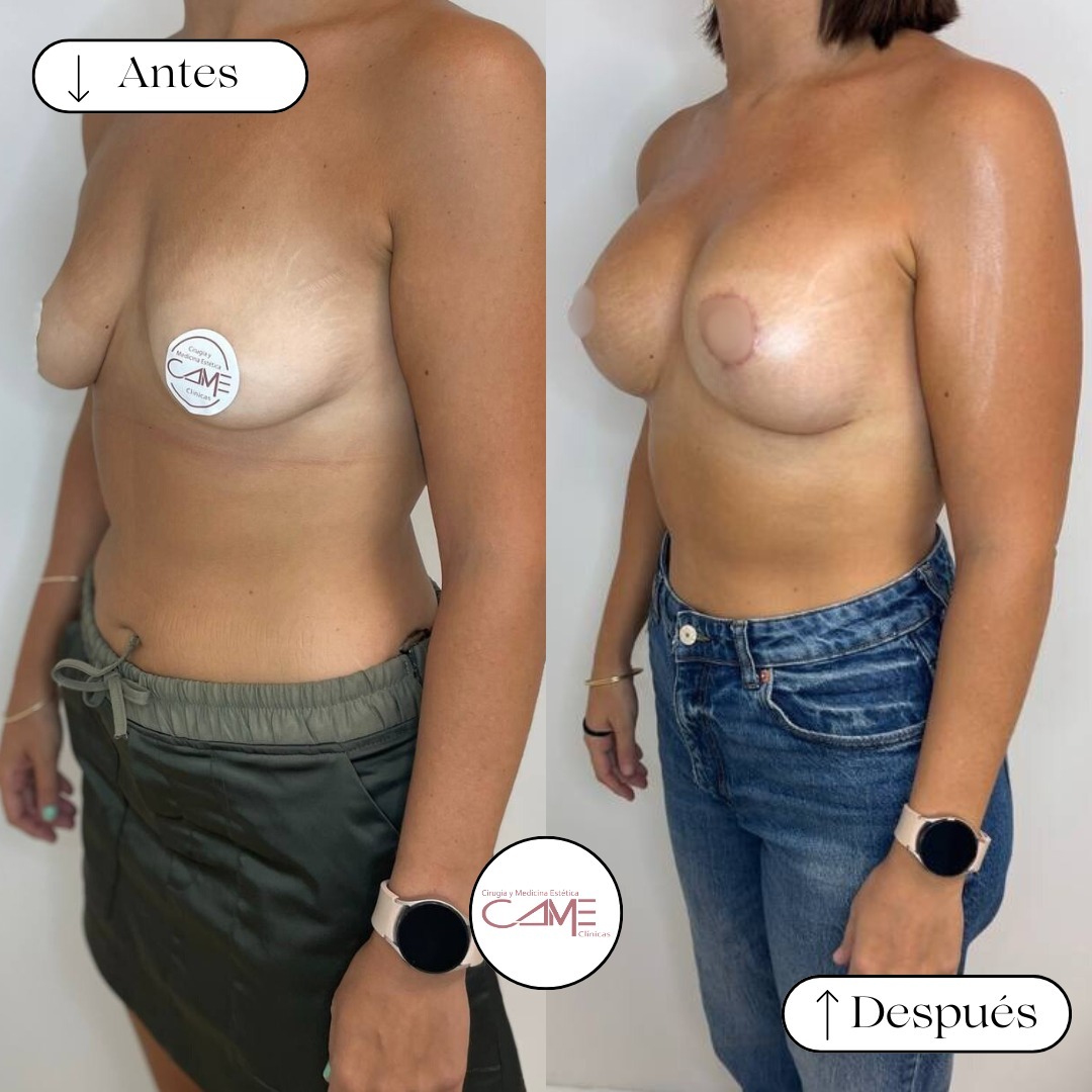 💖✨ En CLÍNICA CAME, hacemos realidad los sueños de nuestras pacientes ✨🌟Si estás pensando en d